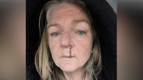 Contributed Mrs Smart in a selfie-style image. A large surgery scar from her lip to her nose can be seen. She wears a black hoodie with the hood placed above her head. 